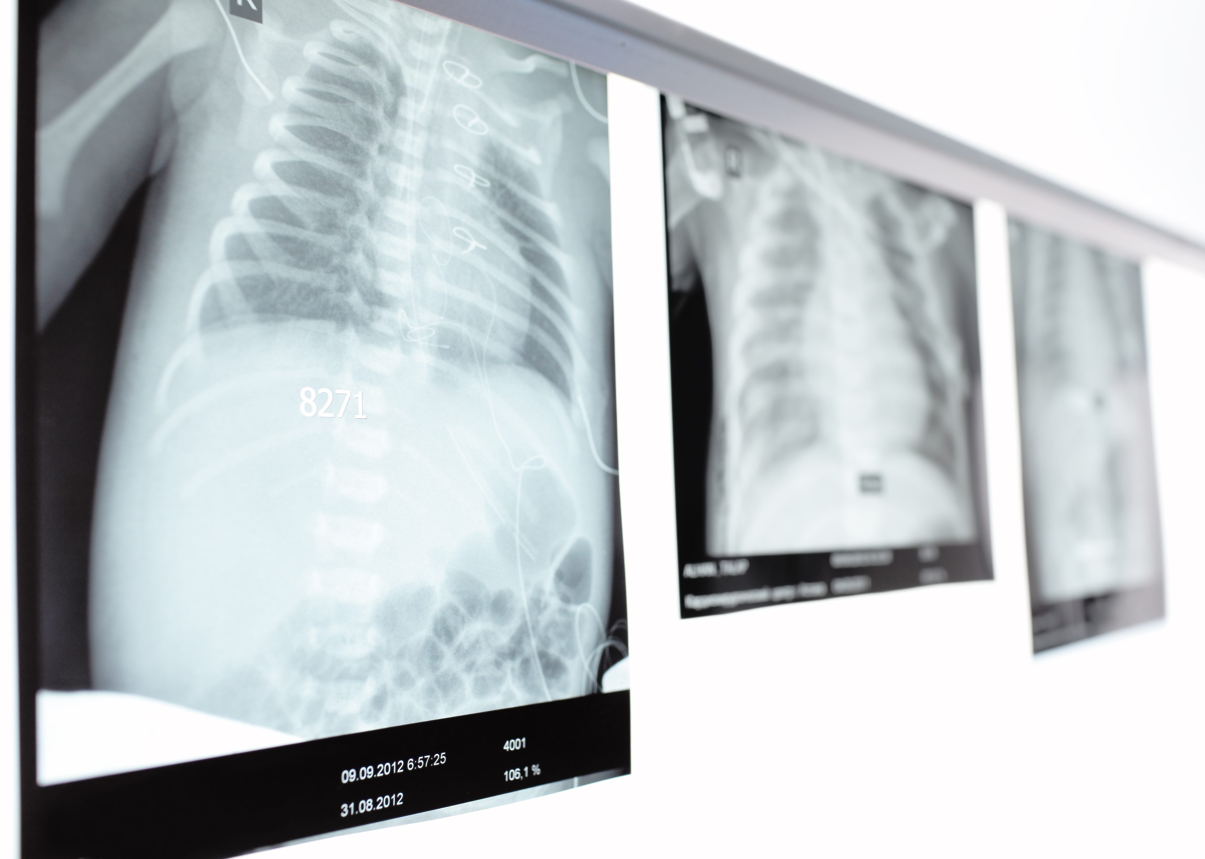 Xray images