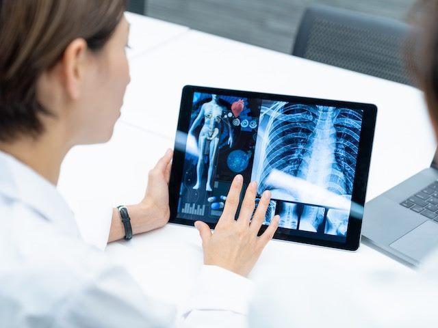 doctor looking at x-ray on a tablet